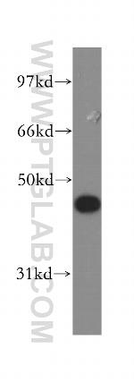 Galectin-4 Antibody in Western Blot (WB)