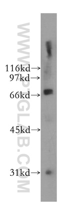 B4GALNT1 Antibody in Western Blot (WB)