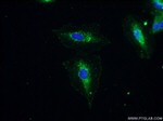 MIP-3-beta Antibody in Immunocytochemistry (ICC/IF)