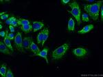 MIP-3-beta Antibody in Immunocytochemistry (ICC/IF)