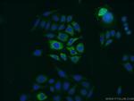 Zinc-alpha-2-glycoprotein Antibody in Immunocytochemistry (ICC/IF)