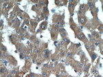 PHKB Antibody in Immunohistochemistry (Paraffin) (IHC (P))