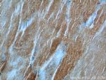 PHKB Antibody in Immunohistochemistry (Paraffin) (IHC (P))