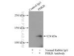 PHKB Antibody in Immunoprecipitation (IP)