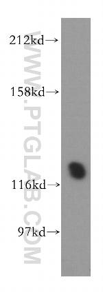 PHKB Antibody in Western Blot (WB)