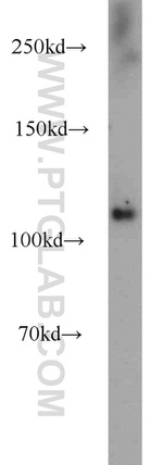 PHKB Antibody in Western Blot (WB)