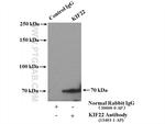 KIF22 Antibody in Immunoprecipitation (IP)