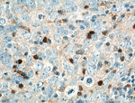 KIF22 Antibody in Immunohistochemistry (Paraffin) (IHC (P))