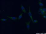 TRIM38 Antibody in Immunocytochemistry (ICC/IF)