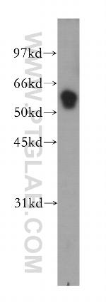 TRIM38 Antibody in Western Blot (WB)