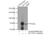 SLC19A3 Antibody in Immunoprecipitation (IP)