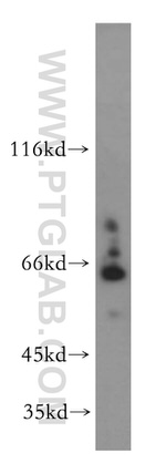 SLC19A3 Antibody in Western Blot (WB)