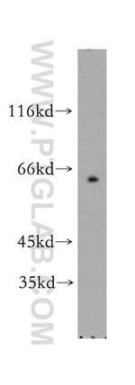 SLC19A3 Antibody in Western Blot (WB)