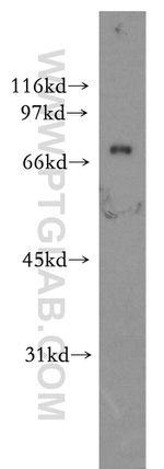 PHACTR4 Antibody in Western Blot (WB)