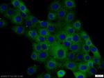 Occludin Antibody in Immunocytochemistry (ICC/IF)