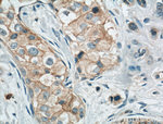 Occludin Antibody in Immunohistochemistry (Paraffin) (IHC (P))