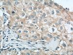 Occludin Antibody in Immunohistochemistry (Paraffin) (IHC (P))