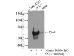 Occludin Antibody in Immunoprecipitation (IP)