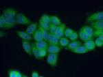 RAB27B Antibody in Immunocytochemistry (ICC/IF)