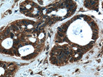 RAB27B Antibody in Immunohistochemistry (Paraffin) (IHC (P))