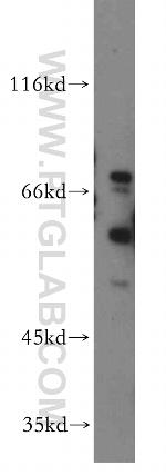 HRH2 Antibody in Western Blot (WB)