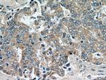 GSK3A Antibody in Immunohistochemistry (Paraffin) (IHC (P))