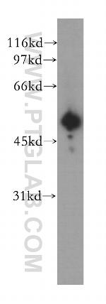 GSK3A Antibody in Western Blot (WB)