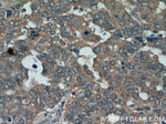 GSK3A Antibody in Immunohistochemistry (Paraffin) (IHC (P))