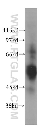 GSK3A Antibody in Western Blot (WB)