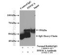 PPP3CA Antibody in Immunoprecipitation (IP)