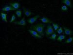 PPP3CA Antibody in Immunocytochemistry (ICC/IF)