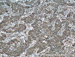 PPP3CA Antibody in Immunohistochemistry (Paraffin) (IHC (P))