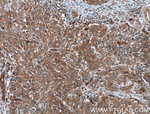 PPP3CA Antibody in Immunohistochemistry (Paraffin) (IHC (P))