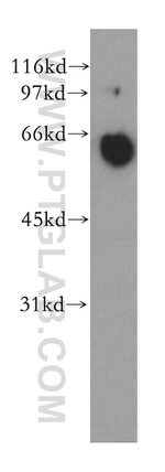 PPP3CA Antibody in Western Blot (WB)