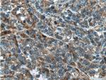 Caspase 8 Antibody in Immunohistochemistry (Paraffin) (IHC (P))