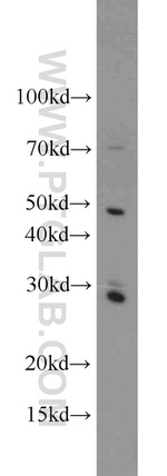 Caspase 8 Antibody in Western Blot (WB)