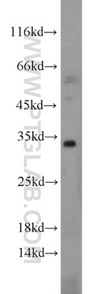 Caspase 8 Antibody in Western Blot (WB)