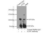 E2F8 Antibody in Immunoprecipitation (IP)