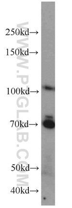 E2F8 Antibody in Western Blot (WB)