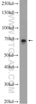 DLAT Antibody in Western Blot (WB)