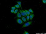 CYP51A1 Antibody in Immunocytochemistry (ICC/IF)