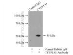 CYP51A1 Antibody in Immunoprecipitation (IP)