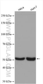 CYP51A1 Antibody in Western Blot (WB)