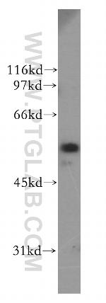 CYP51A1 Antibody in Western Blot (WB)