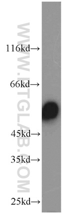 CYP51A1 Antibody in Western Blot (WB)