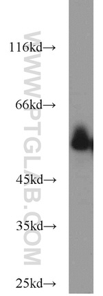 CYP51A1 Antibody in Western Blot (WB)