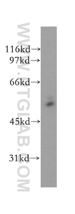 CYP51A1 Antibody in Western Blot (WB)