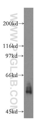 CYP51A1 Antibody in Western Blot (WB)