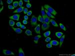 MTUS1 Antibody in Immunocytochemistry (ICC/IF)