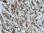 MTUS1 Antibody in Immunohistochemistry (Paraffin) (IHC (P))